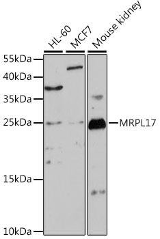 Anti-MRPL17 Antibody