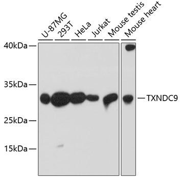 Anti-TXNDC9 Antibody