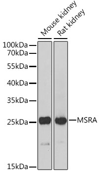 Anti-MSRA Antibody