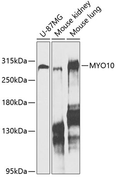 Anti-MYO10 Antibody