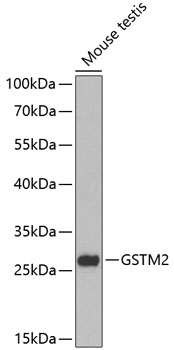 Anti-GSTM2 Antibody