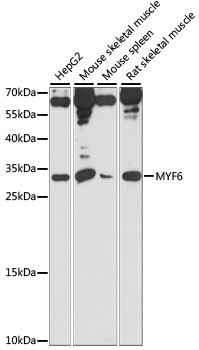 Anti-MYF6 Antibody