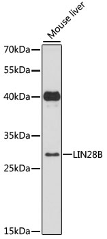 Anti-Lin28B Antibody