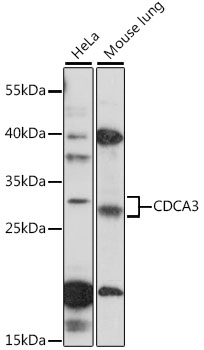Anti-CDCA3 Antibody