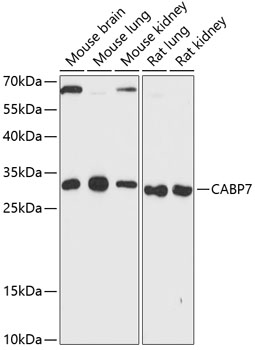 Anti-Calcium binding protein 7 Antibody