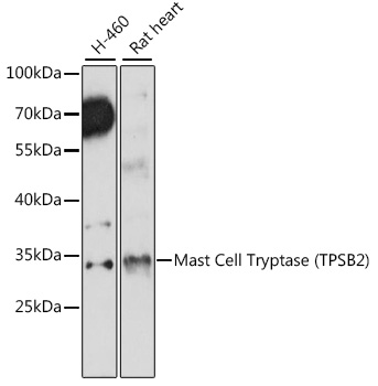 Anti-TPSB2 Antibody