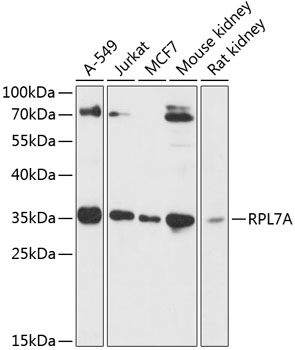 Anti-RPL7A Antibody