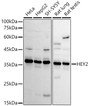 Anti-HEY2 Antibody