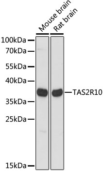 Anti-TAS2R10 Antibody