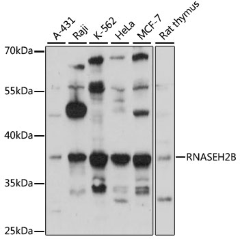 Anti-RNASEH2B Antibody