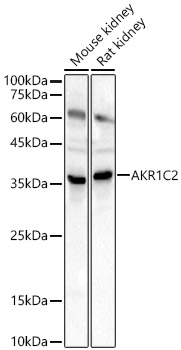 Anti-AKR1C1 / AKR1C2 Antibody