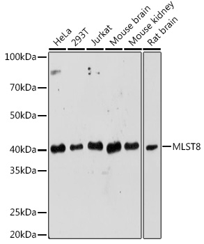 Anti-G protein beta subunit like / GBL Antibody