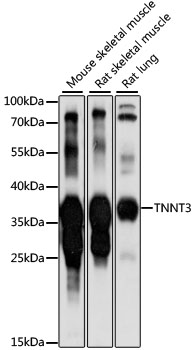 Anti-TNNT3 Antibody