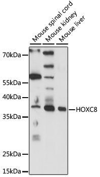 Anti-HOXC8 Antibody