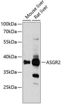Anti-ASGR2 Antibody
