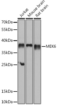 Anti-MKK6 Antibody