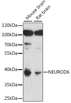 Anti-MATH2 / NEUROD6 Antibody