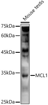 Anti-MCL1 Antibody