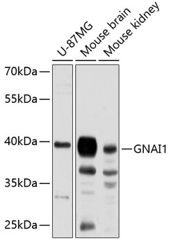 Anti-GNAI1 Antibody