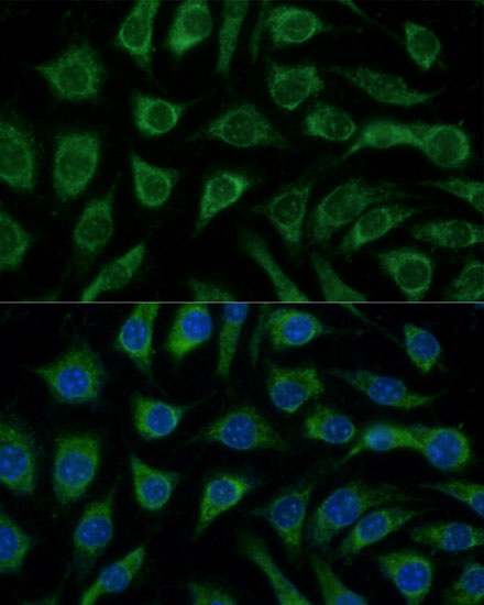 Anti-p38 alpha / MAPK14 Antibody