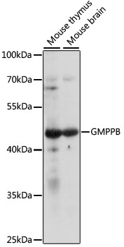 Anti-GMPPB Antibody