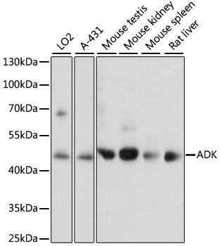 Anti-ADK Antibody