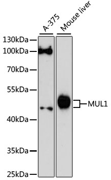 Anti-E3 ubiquitin-protein ligase MUL1 Antibody