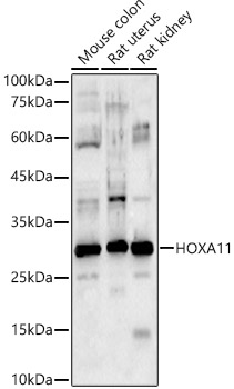 Anti-HOXA11 Antibody