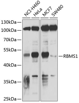 Anti-RBMS1 Antibody