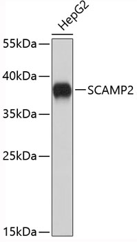 Anti-SCAMP2 / SC2 Antibody