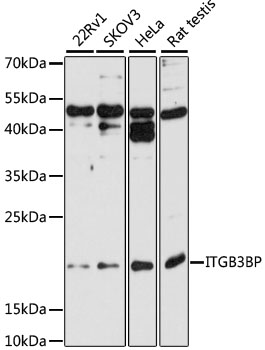 Anti-ITGB3BP Antibody
