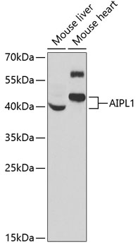 Anti-AIPL1 Antibody