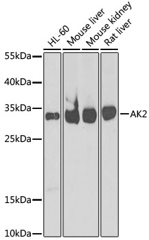 Anti-AK2 Antibody