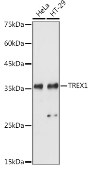 Anti-TREX1 Antibody