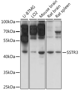 Anti-Somatostatin Receptor 3 / SSTR3 Antibody