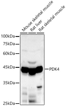 Anti-PDK4 Antibody