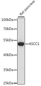 Anti-ASCC1 Antibody