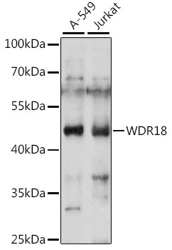 Anti-WDR18 Antibody