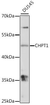 Anti-CHPT1 / CPT1 Antibody