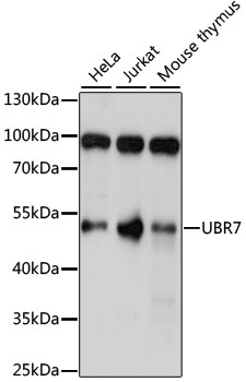 Anti-UBR7 Antibody