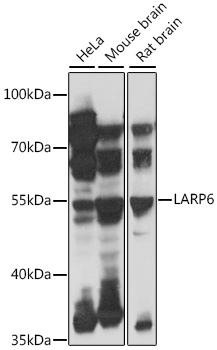 Anti-LARP6 Antibody