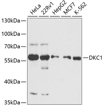 Anti-DKC1 / Dyskerin Antibody