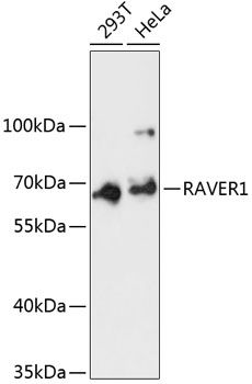 Anti-RAVER1 Antibody