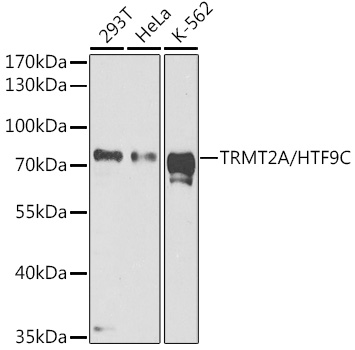 Anti-HTF9C / TRMT2A Antibody