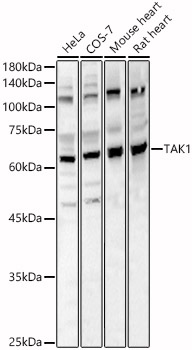 Anti-TAK1 Antibody