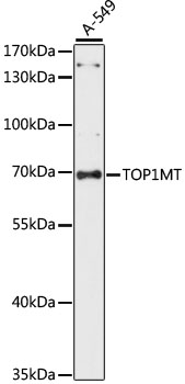 Anti-TOP1MT Antibody