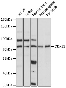 Anti-DDX51 Antibody