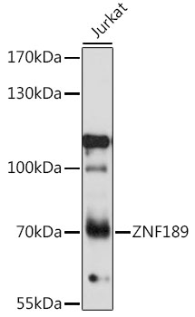 Anti-ZNF189 Antibody