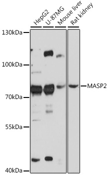 Anti-MASP2 Antibody