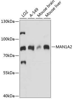 Anti-MAN1A2 Antibody